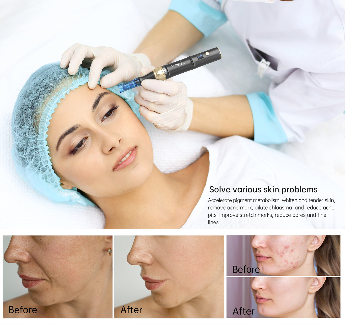 Dr. Pen A8S Ultima Pro Microneedling Pen With 20pcs Cartridges