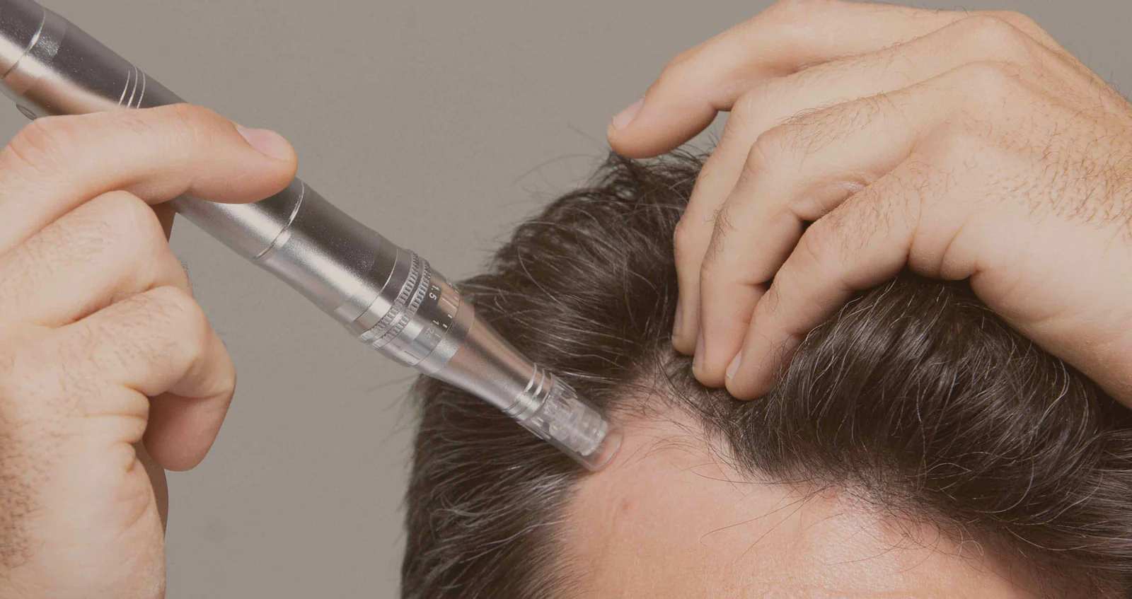 63f3d6ca82cd3b5355b6f95f_myhair_man-microneedling-temple-3_1_1600x dr. pen hair growth microneedling
